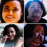 Ex modelo coreana qued� desfigurada al inyectarse silicona y aceite de cocina 