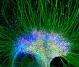 La Corte Suprema de la Argentina declar� inconstitucional el uso p�blico de c�lulas madre 