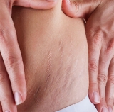 Estr�as: causas y tratamientos