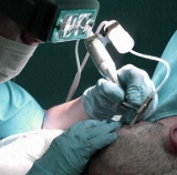 Training intensivo de recuperaci�n y cirug�a capilar en diciembre