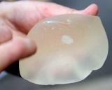 La FDA y los implantes mamarios de gel de silicona: informe de seguridad