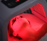 Aplicaciones est�ticas de la fotobiomodulaci�n